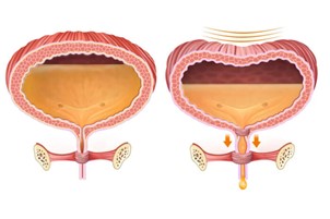 desenho de bexigas